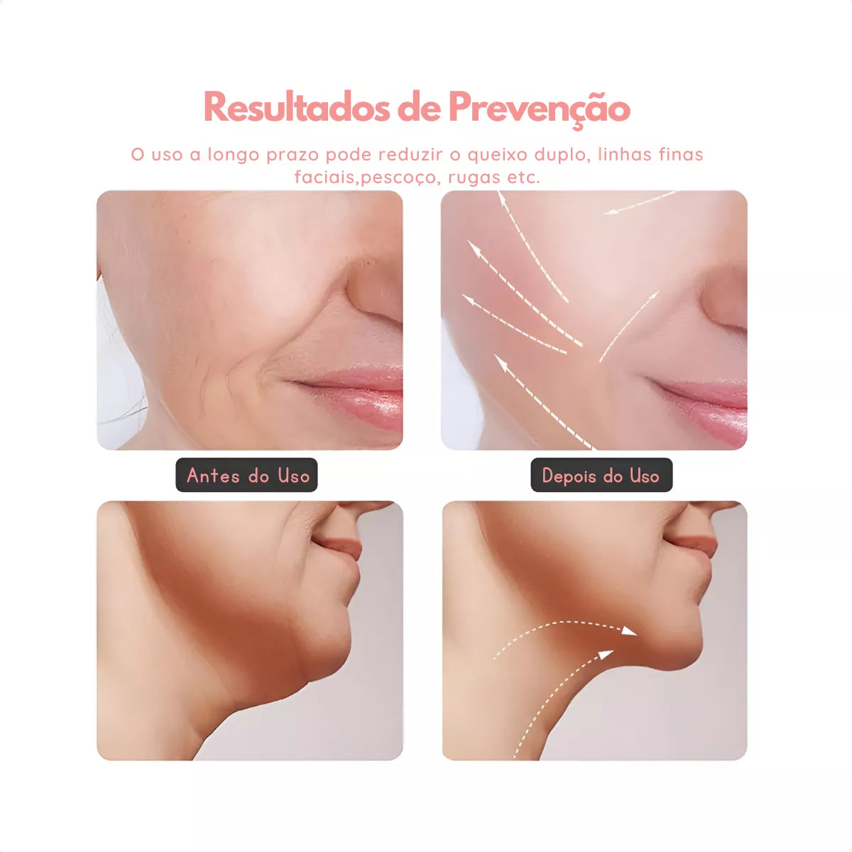 MASSAGEM FACIAL Bivolt  -  Led Aparelho Tratamento Com Luz Bivolt -  (Cores Sortidas)
